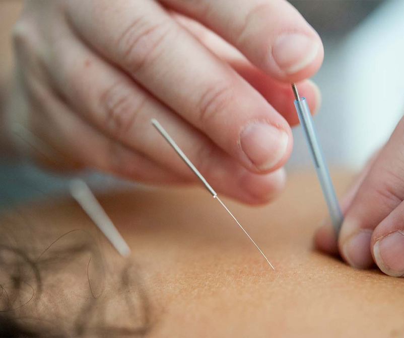 Medecines douces soins energetiques